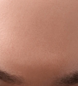 Brighter, Clearer, Radiant Skin - After