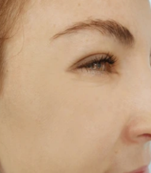 Up to 99% Reduction in Wrinkles & Fine Lines - After