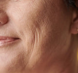Wrinkles & Fine Lines