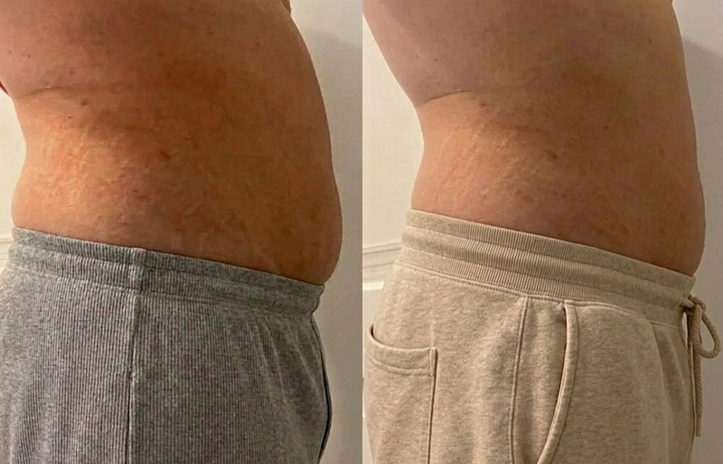 Muscle Recovery