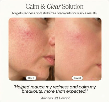 High Frequency & Anti-Acne Wand | Derma Revive™