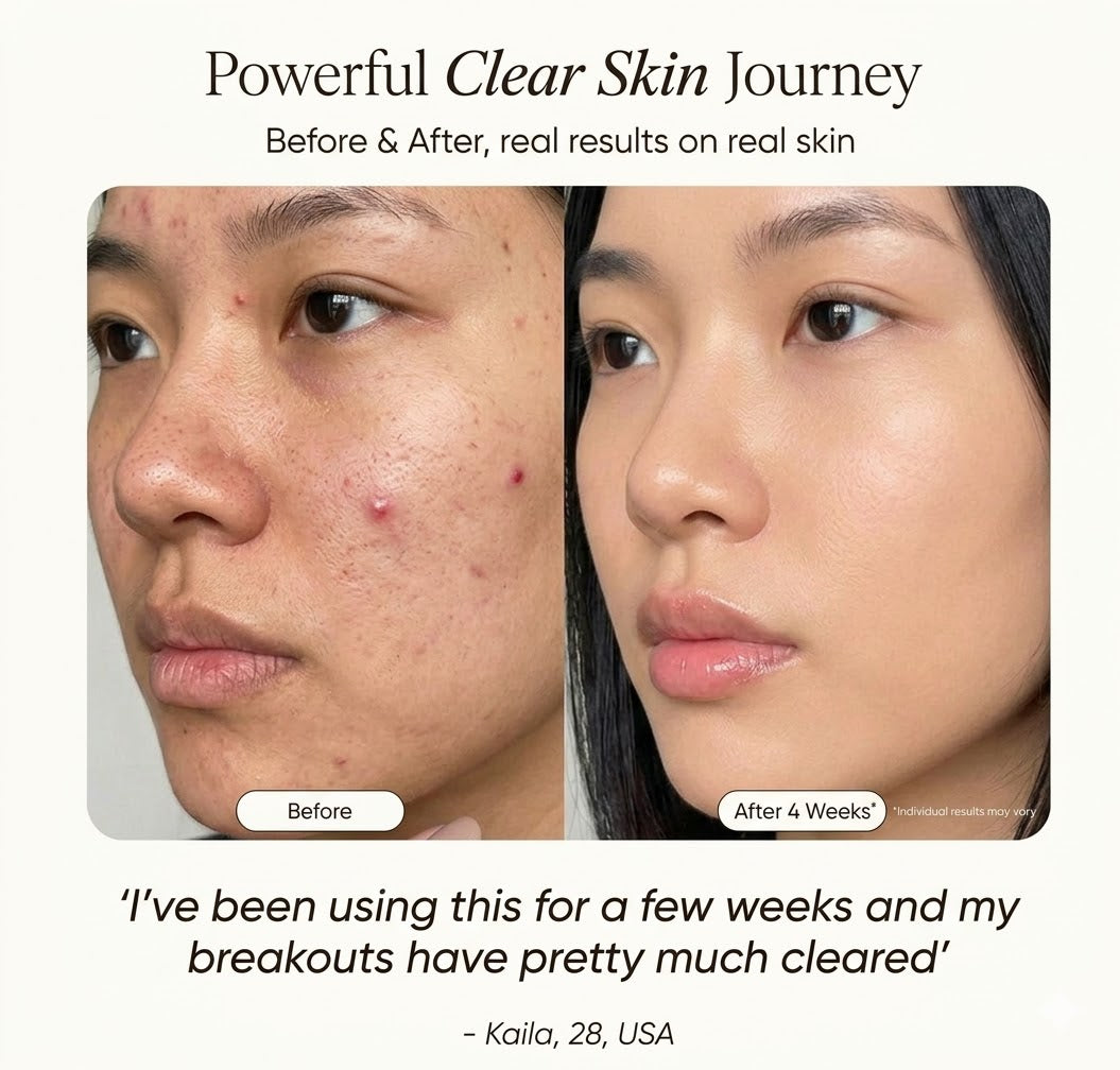 High Frequency & Anti-Acne Wand | Derma Revive™